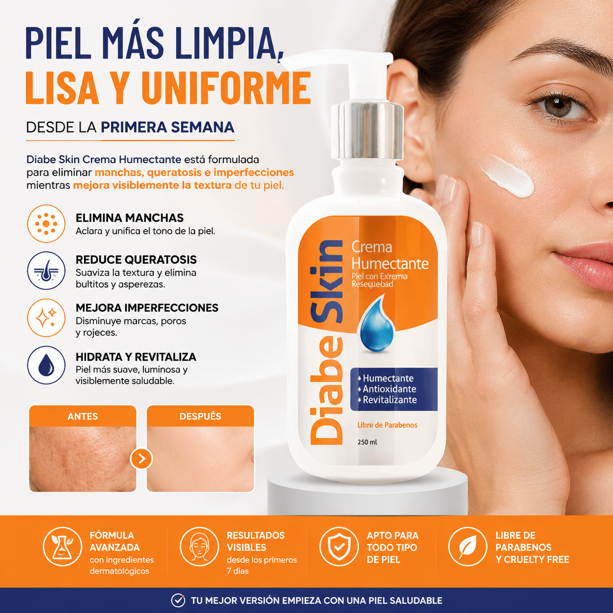 Crema Aclaradora Humectante - Diabeskin elimina manchas y queratosis (99.9 Efectivo)