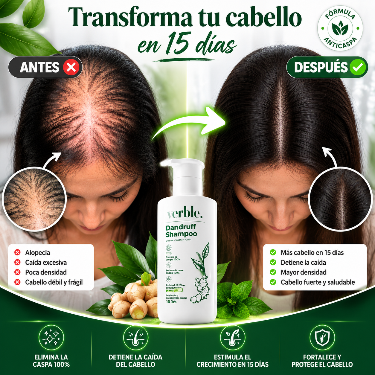 Verbel Dandruff -  Shampoo dermatológico 100% Efectivo.